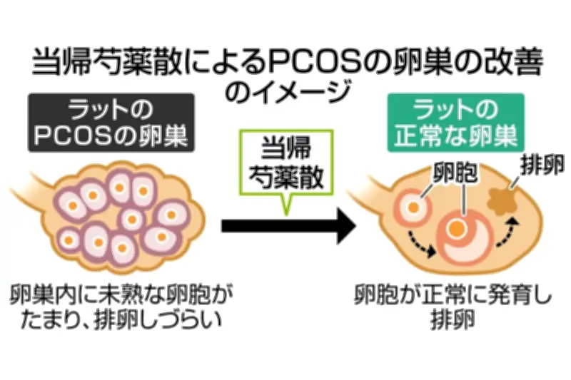 漢方薬「当帰芍薬散」が多嚢胞性卵巣症候群に効く仕組みを解明　愛知医科大学などが動物実験で明らかに