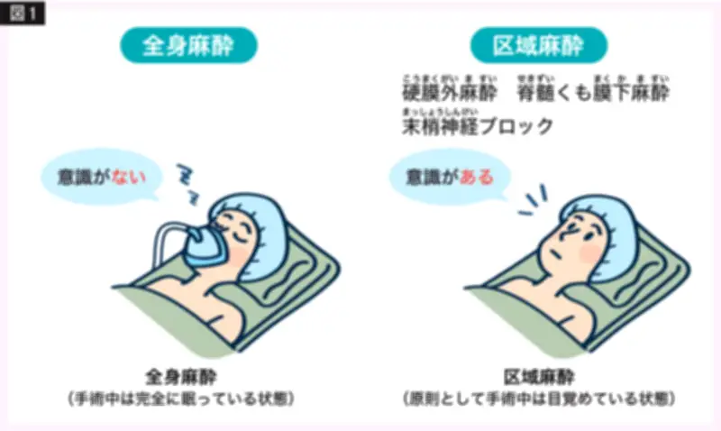 麻酔の種類と術前準備を徹底解説 福島赤十字病院の専門医が詳説