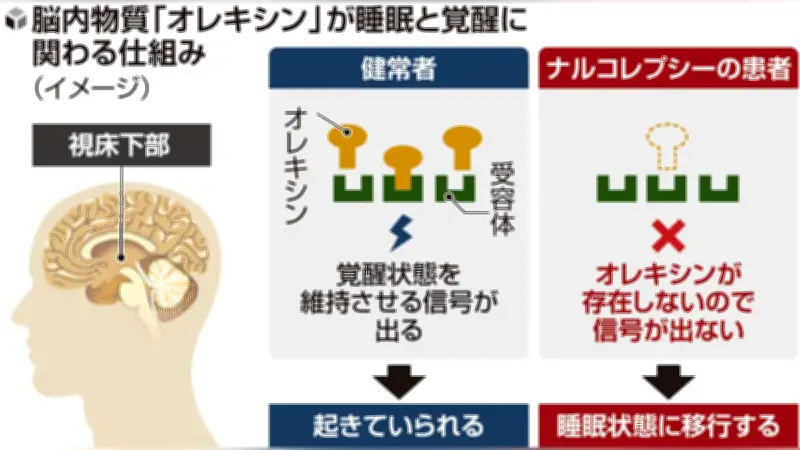 武田薬品、ナルコレプシー新薬「オベポレクント」を承認申請 オレキシン欠乏を補う世界初の治療薬へ