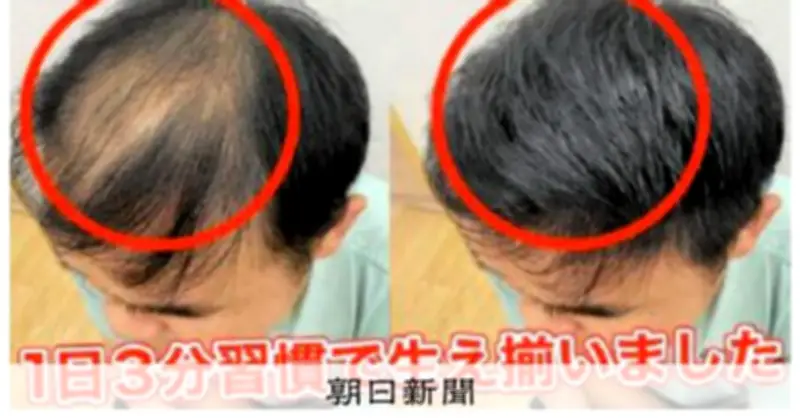 育毛剤「ノーベル賞受賞級」と虚偽表示 東京都が販売業者に措置命令