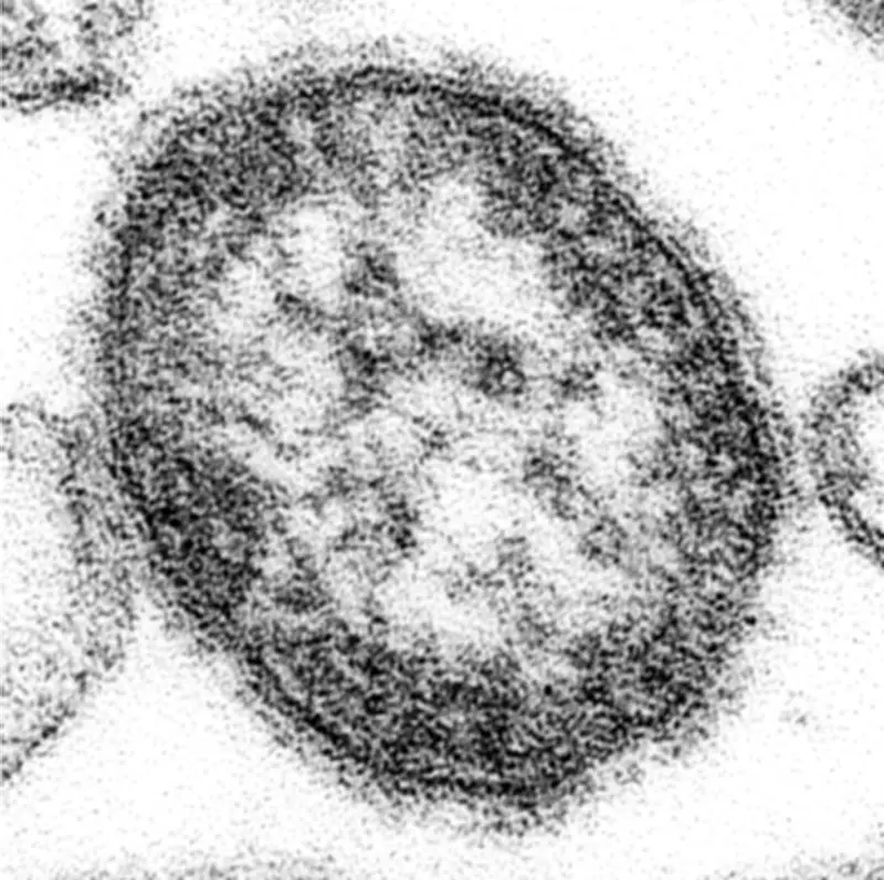 はしか患者数が急増、累計236人に 昨年同時期の3.6倍に達する