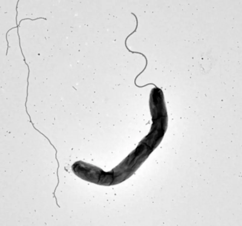 コレラ菌が光で活発化 琉球大など研究発表、感染制御の新たな手がかりに