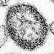 はしか患者数が急増、累計236人に 昨年同時期の3.6倍に達する