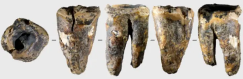 ネアンデルタール人が5万9千年前に石器で虫歯治療、最古の事例か