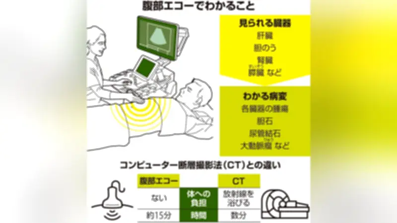 家計簿アプリで簡単節約！AIが自動分類で支出管理を効率化