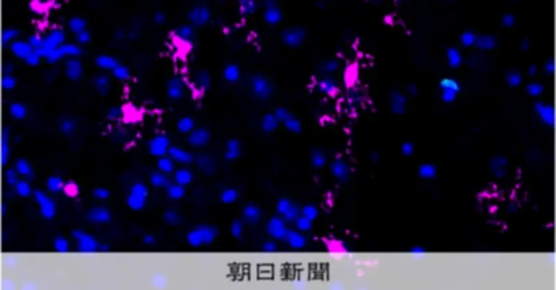 傷ついた脳の回復を持続させる仕組みを解明、脳梗塞治療に期待