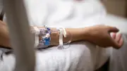 腹膜播種に希望の光、医師が治療諦める構造的問題を打破へ